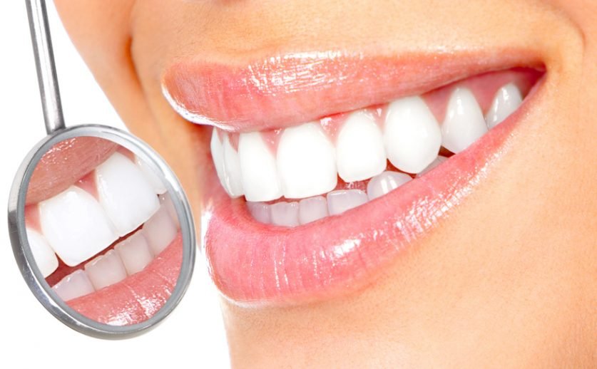How to apply dental veneers?