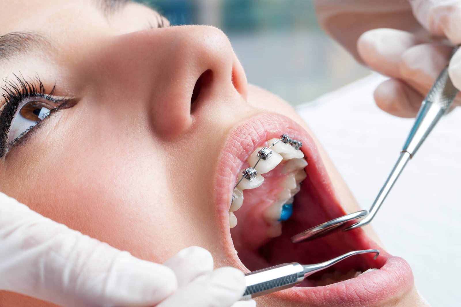 affordable braces near me pediatric dentists Miami fl